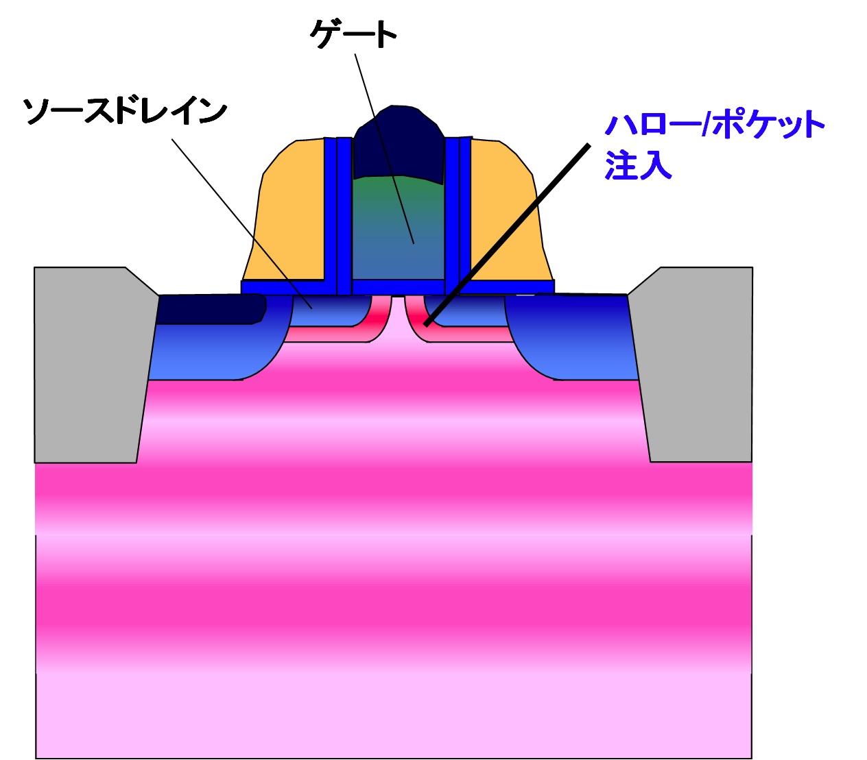 ハロー/ポケット注入