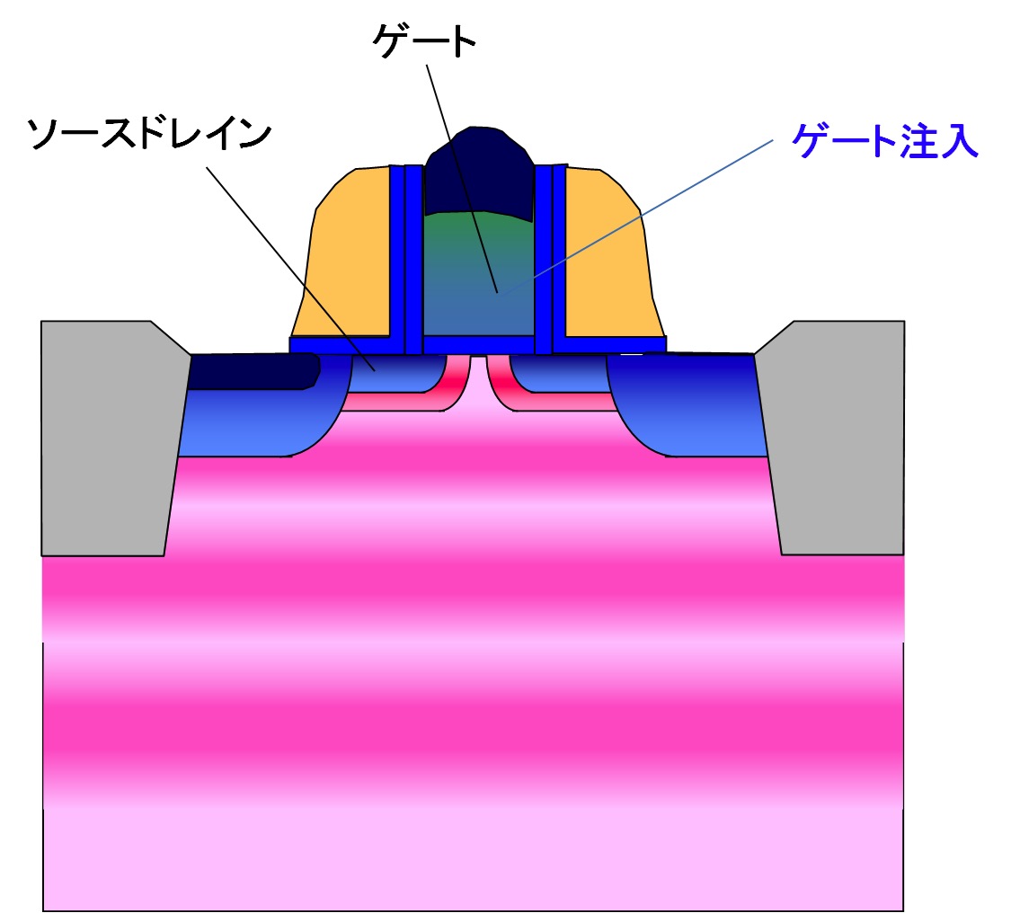 ゲート注入